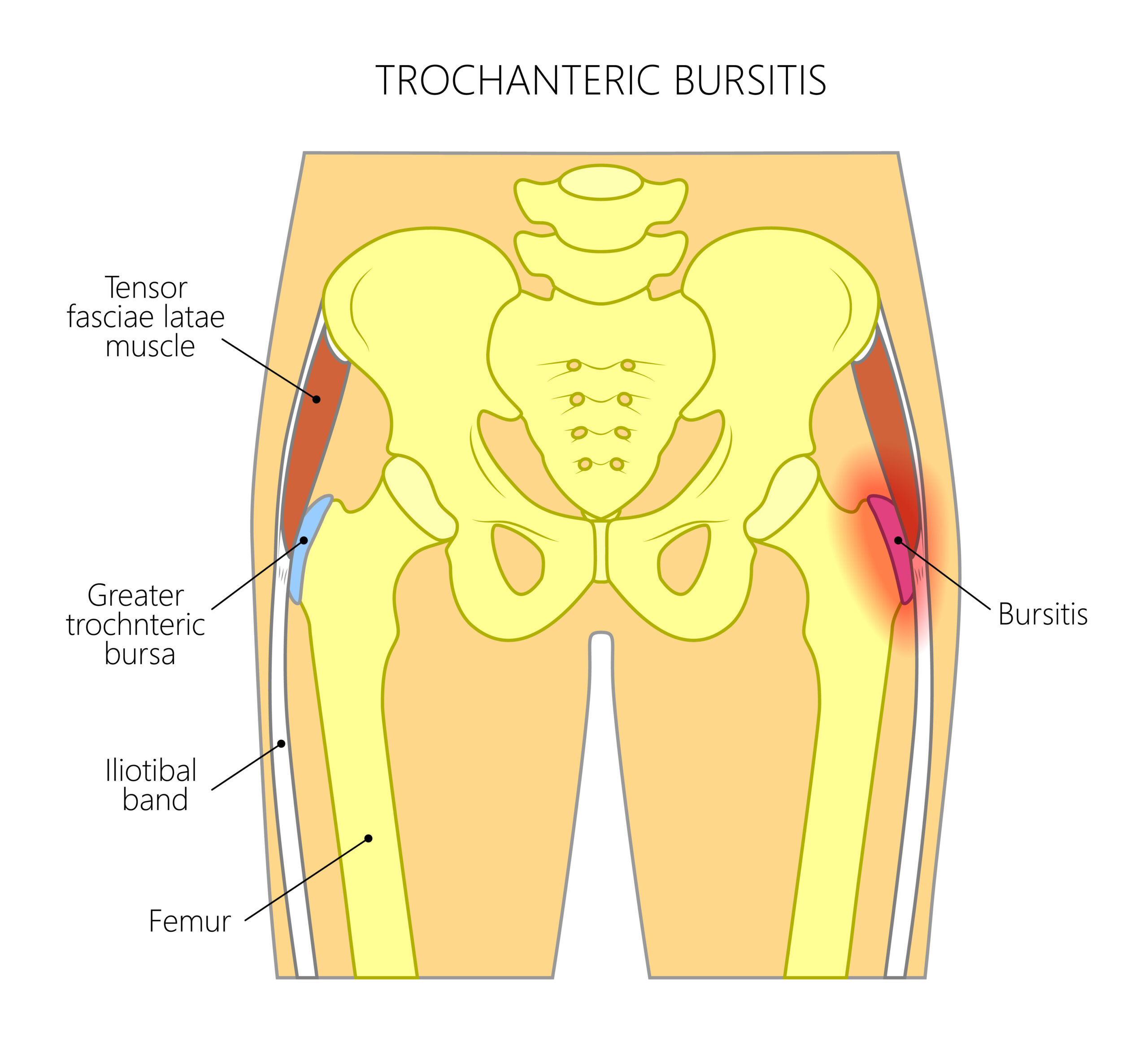 knee-pain-charts